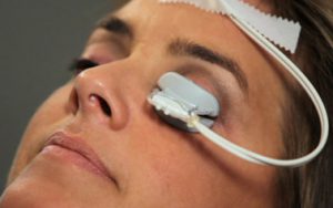 LipiFlow® uses a disposable eye piece to apply controlled heat to the inner eyelids and intermittent gentle pressure to the outer eyelid.